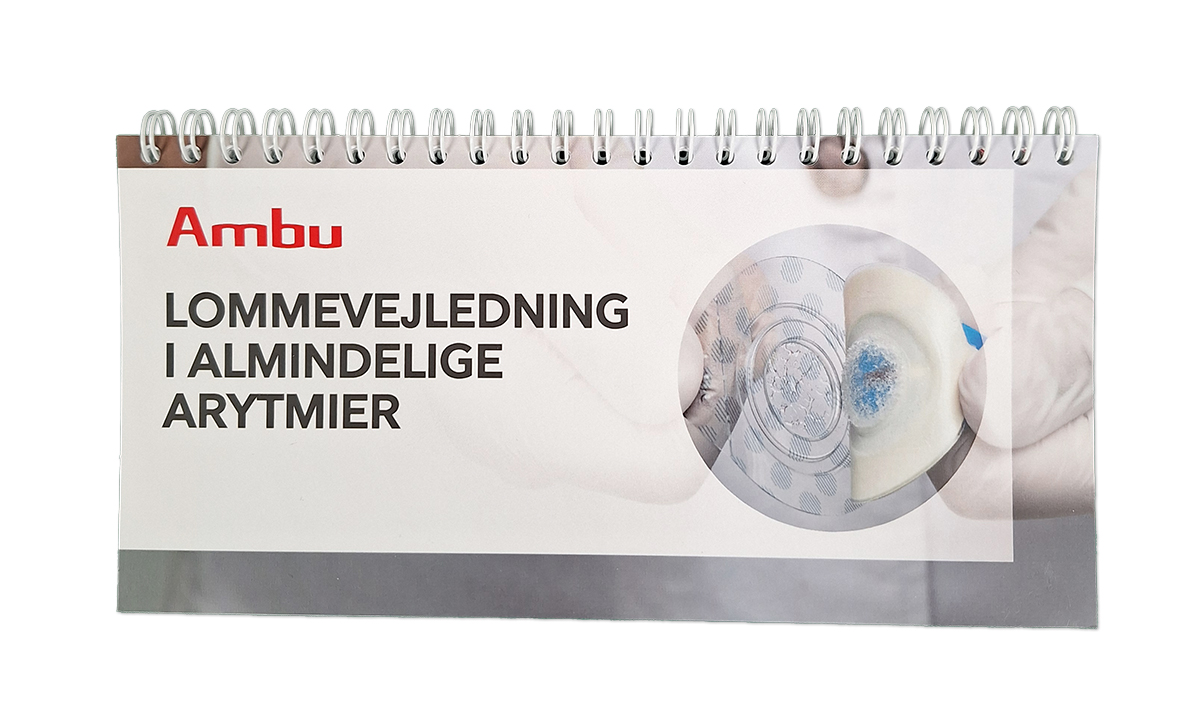 Lommevejledning i almindelige arytmier
